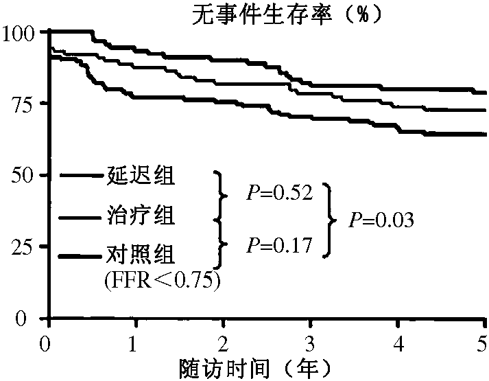 指導PCI手術
